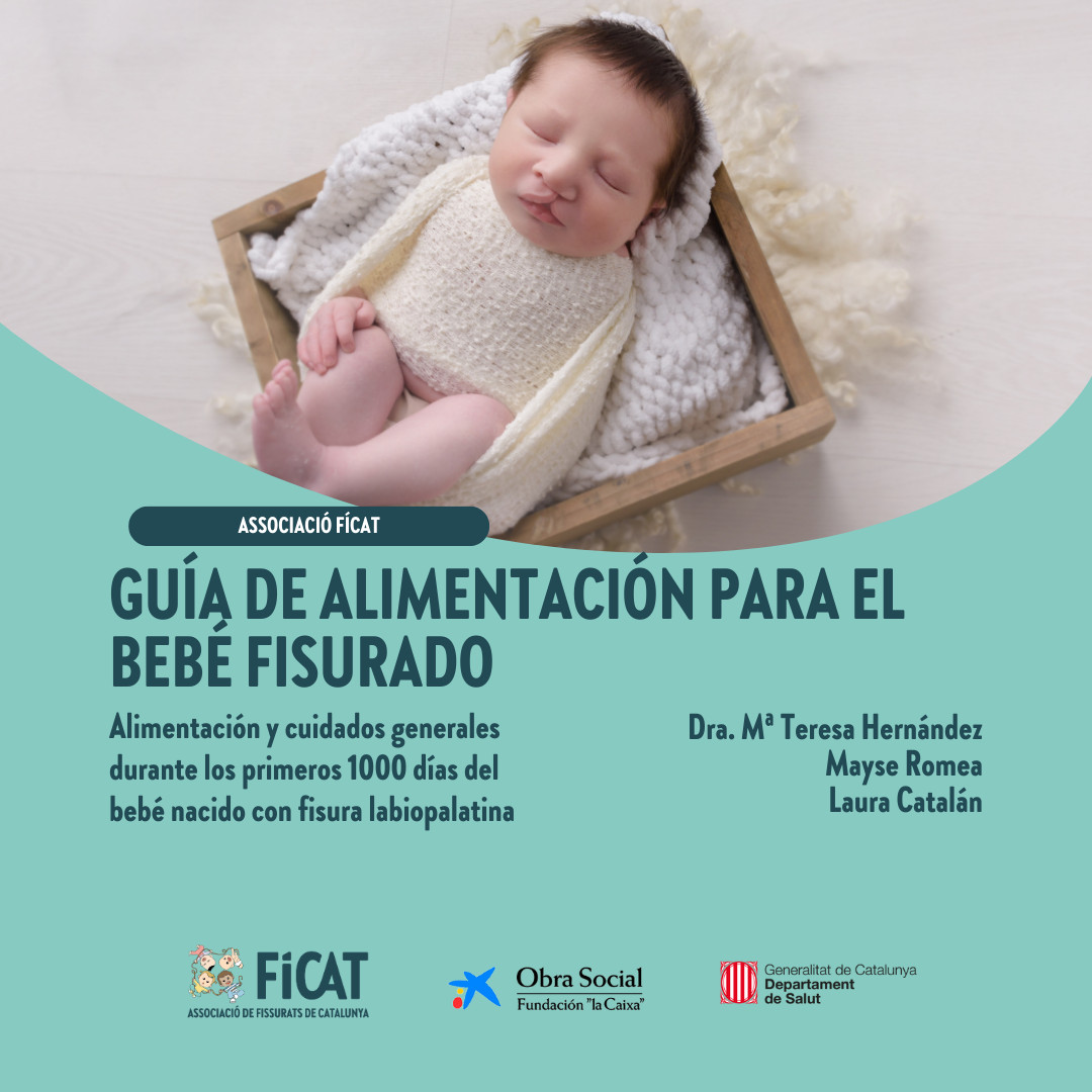 Guía de alimentación para el bebé fisurado